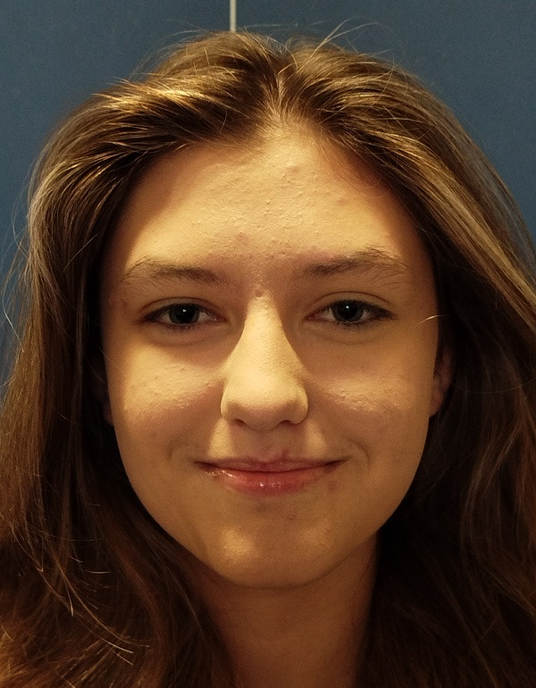 Šišková Zara Izabel