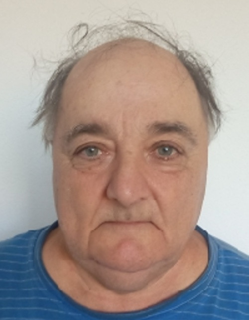 Zemanovič Hubert