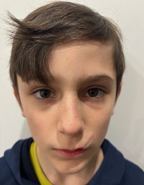 Franko Hugo