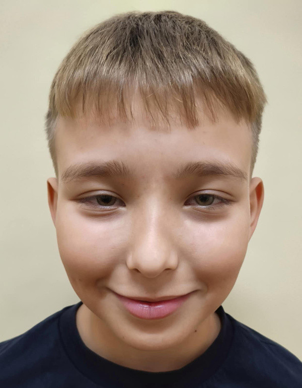 Mišík Tobias